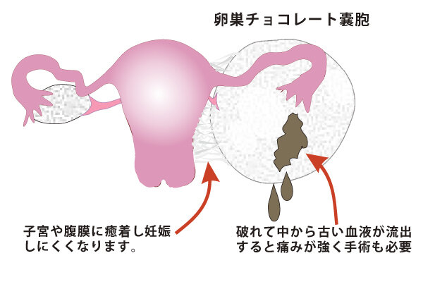 それは一般的ですか?