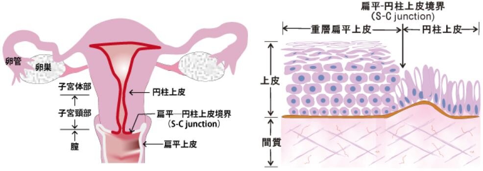 外陰上皮内腫瘍 3 はどのように診断されますか?