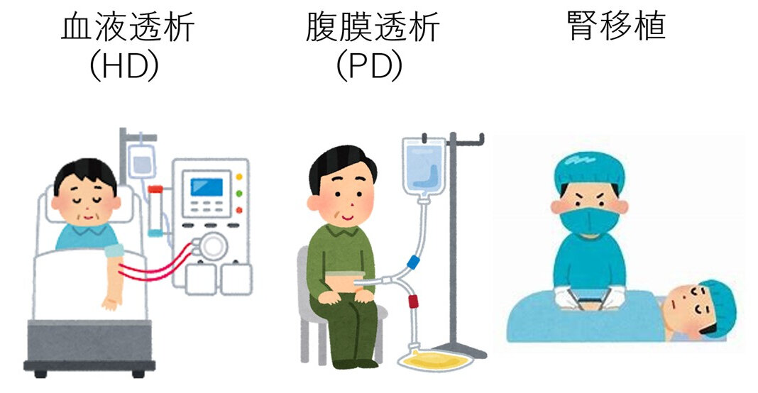 血液透析はどの程度効果がありますか?